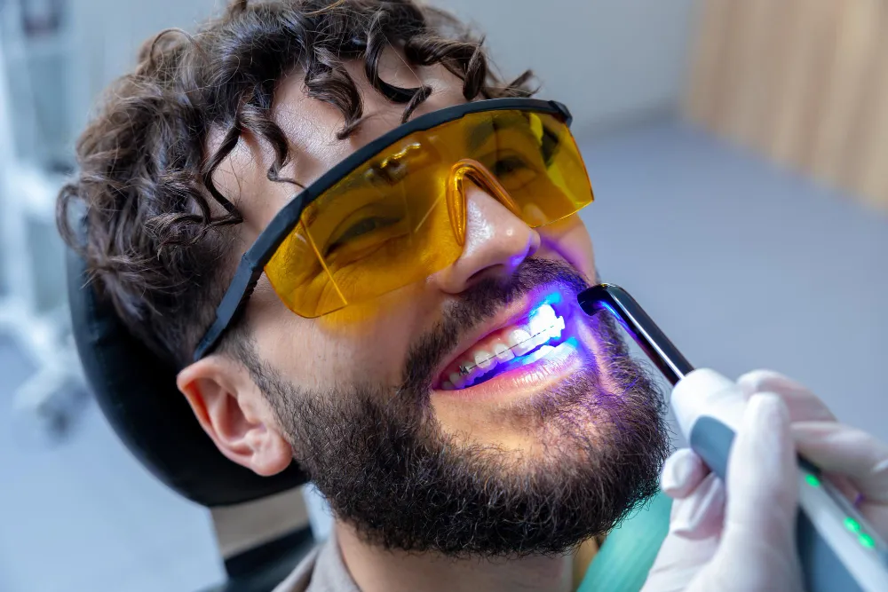 professioneel tanden bleken professioneel tanden bleken